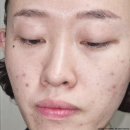얼굴 스크럽 부드러운 피부 만드는 <b>하루</b><b>하루</b><b>원더</b> 필링젤 피지 각질 제거 완료!