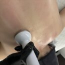 맥스컴퓨터 - 동구 대학길 125 | 순수에스테틱 인비덤맥스 등관리 후기, 해운대에스테틱 바디관리 만족했던 곳