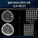 제이엘케이(JLK) 뉴시스