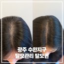 탈모퀸 | 광주탈모관리 가르마 비어보여서 다녀온 수완지구 탈모퀸 후기