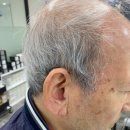 분당-354 | 분당보청기 고민하다 방문한 성남독일보청기 솔직후기