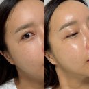 피부노화 안티에이징 아드망 항당화 앰플