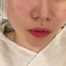 유앤영피부과의원 네이버블로그