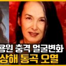 조용원 교통사고 후 갑자기｜얼굴변화 자존심상해 눈물흘렸다 이미지