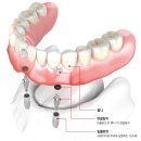 비우고채우는치과의원 이미지