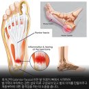 건강한발