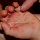 소아랑한의원 이미지