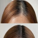 두피문신 부작용, 진짜일까? 시술 전문가가 솔직하게 알려드립니다 (어반던트 후기 포함)