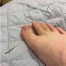 20235537 김정곤 의안과제 (2) 이미지