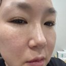 엠제이메디 | 바르고자는 톤업크림 추천! 메디테라피 핑크 블러크림으로 민낯 자신감 챙긴 솔직후기