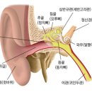 스타키보청기종로센터