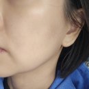 세븐일레븐 성남신흥부자점 | 성남 온다·레티젠 후기｜40대 피부 결·탄력 좋아진 리얼 변화