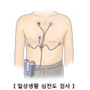 세동