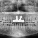 수플러스치과기공소 이미지