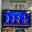 서울운동교정센터 | 강동체형교정 더올바로척추체형교정운동센터 거북목 자세 점검 후기