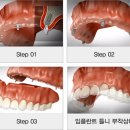 서울모아치과 이미지