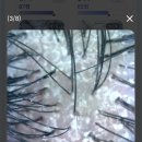 모스테틱광주 | 숨겨진 두피의 이야기를 듣다: 모스테틱광주에서의 깊이 있는 경험