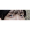 압구정 다크서클주사 림피드주사 내돈내산 후기 (광고❌ 홍보❌)
