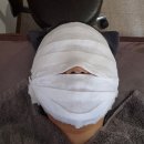자연안에한의원 - 중구 구덕로 80 | 로담한의원 후기 여드름흉터치료 12회차 후기