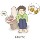 직장암 (Rectal Cancer) 이미지