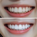 평택하얀치과의원 | 세교동 치과, 치아미백을 꼭 해야하는 이유