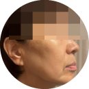 대소빌딩 | 문래 피부관리 미플 / 여름맞이 기미 잡티 문래동피부관리 후기