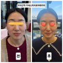 경산피부,2025 이혈테라피와 두피근막 키네스테틱 아로마테라피 1월 수업 후기-귀와 인체의 상관관계