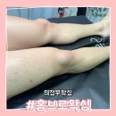 홍브로왁싱 | 의정부왁싱은 홍브로왁싱 추천