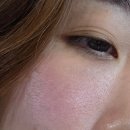 내돈내산 리투오! 매달 맞는 사람의 솔직후기 (효과, 가격, 멍 붓기 엠보 통증, 신논현 피부과)