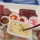 작은성모의원 | 부천담낭병원 성모K외과 단일공복강경으로 통증 줄인 후기