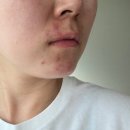 종암떡집 | 꼬모 왁싱&뷰티ㅣ성북구 피부관리ㅣ문제성피부, 여드름, 아토피, 모공 전문ㅣ솔직후기