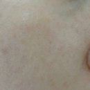 이지은레드클럽 | [화곡역 이지은 레드클럽] 강서구 화곡동 피부관리 추천 - 이지은 레드클럽 화곡역점 (영업종료)