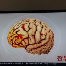 뇌에 미치는 미세먼지 이미지