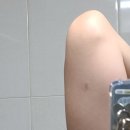 생리통 완화와 액상철분 효과는 굉장했다 (feat 임플라논 제거 후기) 내돈내산