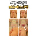 서면피부관리 미유에스테틱 하이푸리프팅 후기