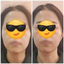 아모르체형교정