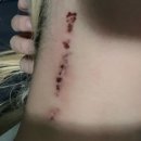 별내약국 | 남양주 피부과 타투제거 1회차 통증 가격 후기 문신제거 후 별내 카페까지