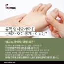 나도손톱 레푸스 개봉점 이미지