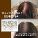 잠실 잠실새내 여자 두피문신 잘하는곳 가르마 정수리 후기