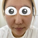 대송의원 | 화곡역 피부과에서 포텐자 받고 왔어요