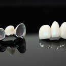 정이치과기공소 이미지