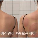 뷰티새로움