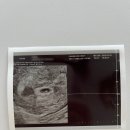 참조은산부인과의원 이미지