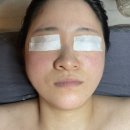 인천시청역(인천1호선) | 구월동에스테틱 에스테티아 인천구월1호점 윤곽관리 얼굴 비대칭 교정 솔직후기