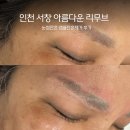 센타프라자 | 서창동 눈썹문신케어는 인천 눈썹잔흔 아름다운리무브