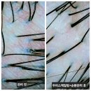 양정24시약국 | 서면두피관리 숲칼프토탈뷰티 부산두피스케일링