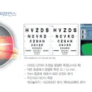 알로뷰안경 이미지