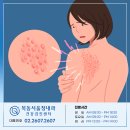 목동서울청내과의원 네이버블로그