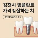 김천우리들치과의원 | 김천 치과 임플란트 잘하는곳 가격 비용 정리 (2025년 기준)