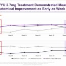 K Implant(케이 임플란트) | 경쟁사 DURAVYU vs 제형 최적화 AXPAXLI
